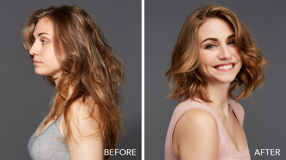 Before and After: Fixing Bad Haircuts