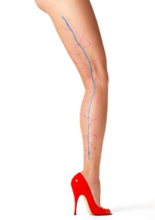 acne legs