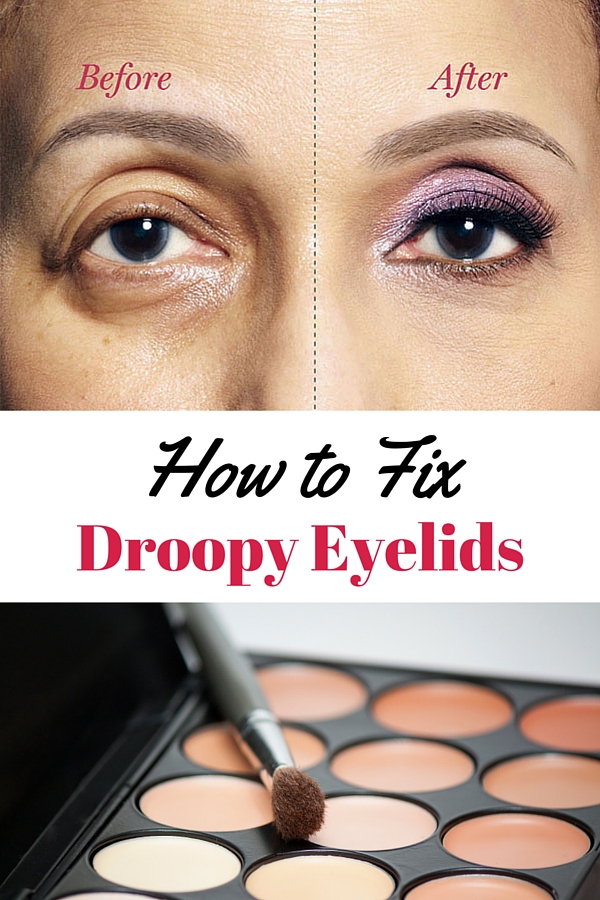 how to fix droopy eyelids